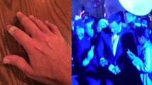 Jimmy Fallon Falls and Injures Another Finger