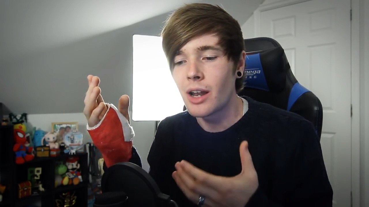 BROKEN HAND UPDATE #2!!