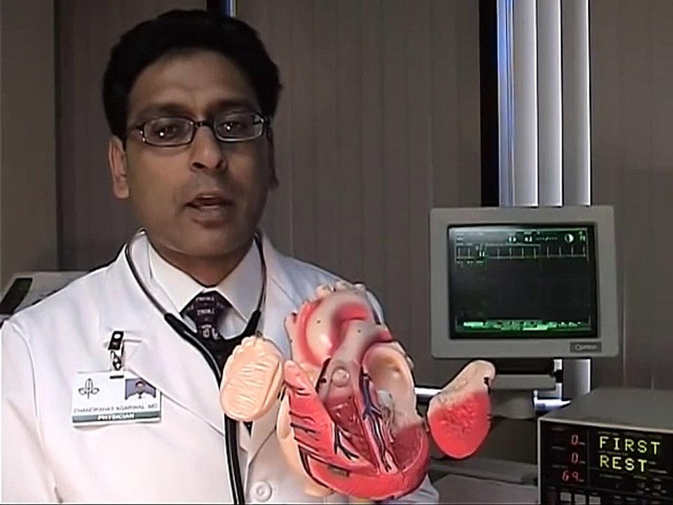 Heart attack risk and factars (3)