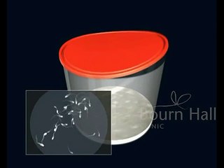 Protocolo Estimulacion - Bournhall Clinic (Best IVF Center)