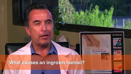 What causes an Ingrown Toenail?