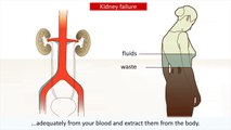 Kidney disease - Causes and treatment of kidney failure