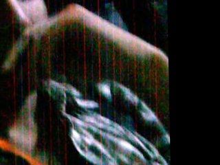 una simple coincidencia