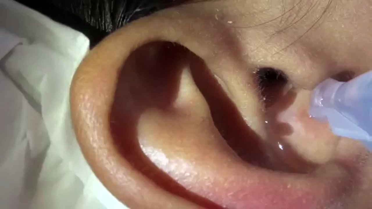 Il sort une araignée de son oreille avec des gouttes d'eau