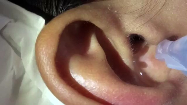 Il sort une araignée de son oreille avec des gouttes d'eau