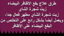 وصفات منزلية علاجية لبقع الاظافر البيضاء