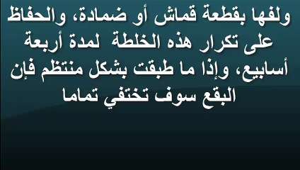 وصفة الماء الفاتر والخل الابيض لعلاج بقع الاظافر البيضاء