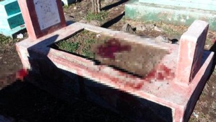 Diyarbakır'da Mezarlığa Saklanan Patlayıcı Bulan 2 Çocuk Ağır Yaralandı