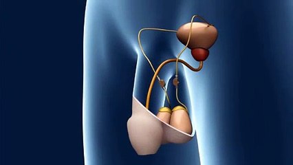 Erkekler İçin Doğum Kontrol Cihazı Üretildi