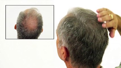 caboki/toppik contre pluie et vent algerie 0550603425 /ضد المطر والرياح والعرق