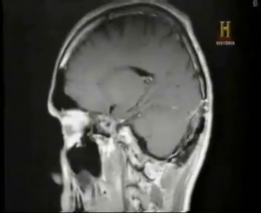 Memoria: Falsos recuerdos (General Patton)