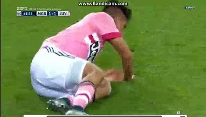 Paulo Dybala Gets Injured M'gladbach 1-1 Juventus 3.11.2015 HD