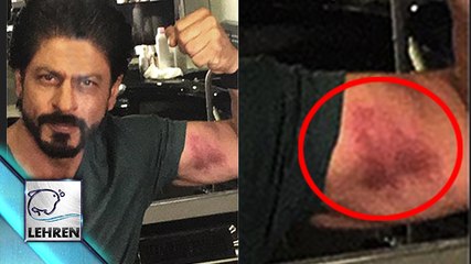 Shahrukh Khan FLAUNTS His 'LOVE BITE' | DILWALE