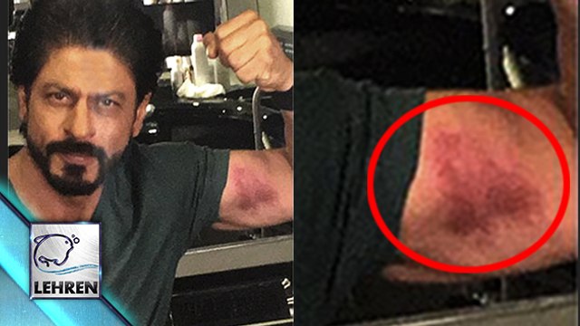Shahrukh Khan FLAUNTS His 'LOVE BITE' | DILWALE