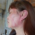 Nghệ An: Một phụ nữ có dấu hiệu bị đánh sau khi làm việc với công an phường