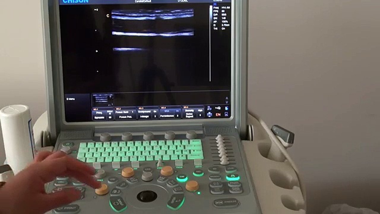 Chison Q9 vet veterinary color ultrasound - how to operate it