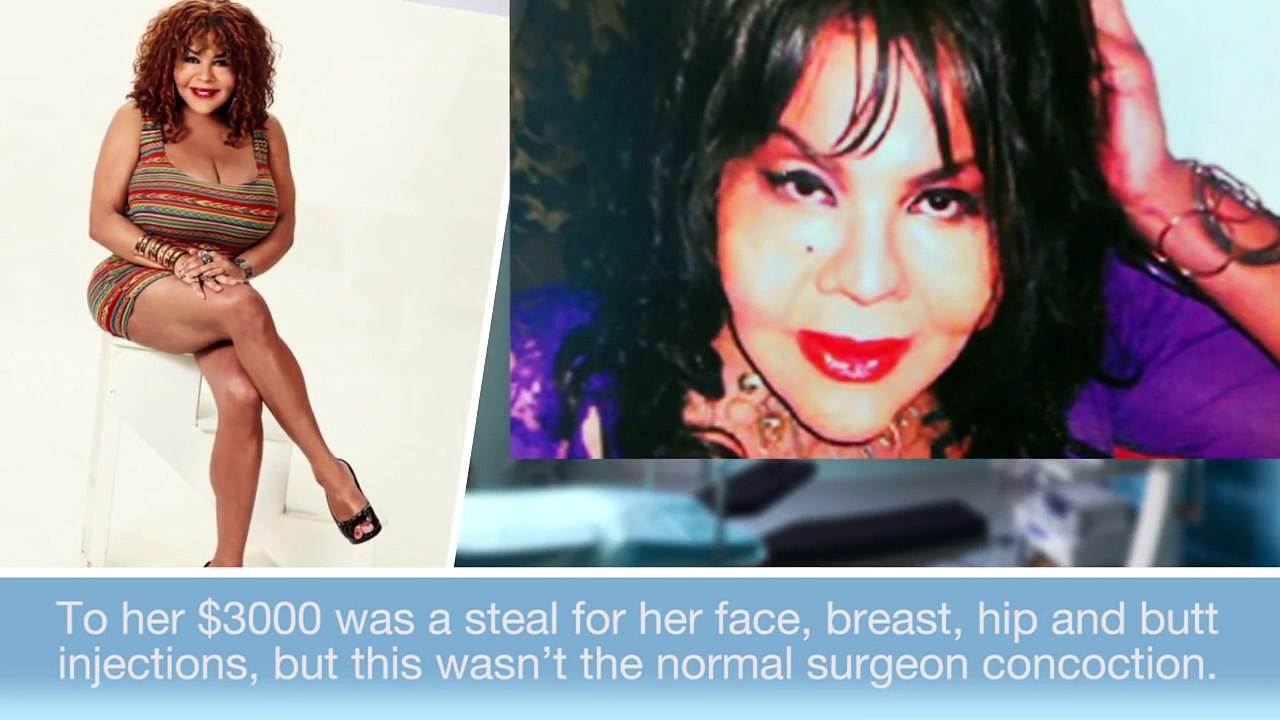 10 Cases of Plastic Surgery Gone Terribly Wrong