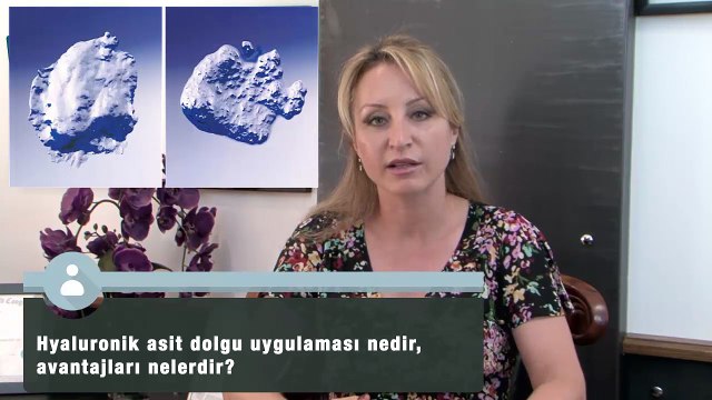 Üç Boyutlu Yüz Dolguları İle Ameliyatsız Yüz Germe