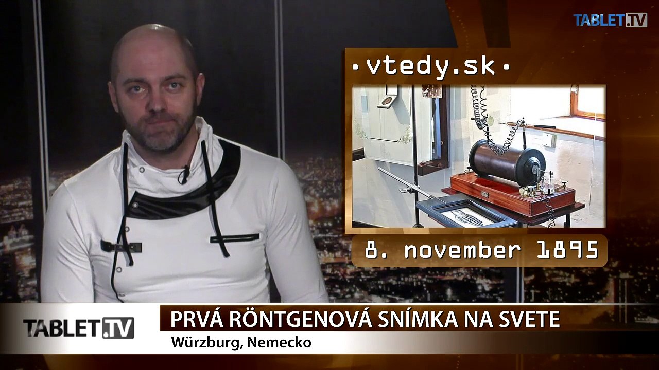 Röntgenová snímka uzrela svetlo sveta pred 120 rokmi