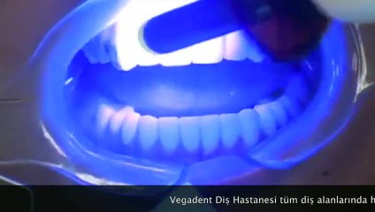 Diş Kaplama ankara Vegadent yenimahalle batıkent dis fiyatları www.vegadent.net