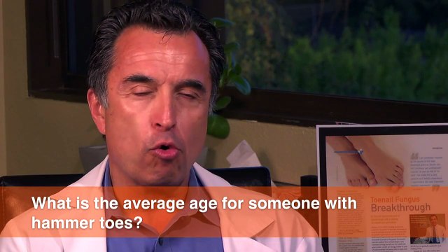 What's the common age to develop hammer toes?