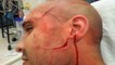 Corrections Officer Slashed in the Face at Rikers Island