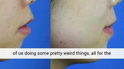 Rhinoplasty Roswell Georgia Call To RENT SPACE 413-648-4336