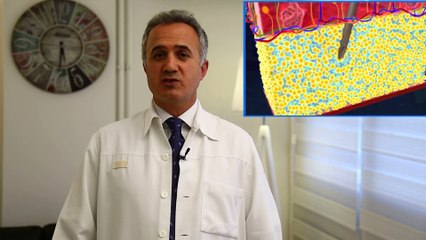 Op. Dr. Sadullah Karun - Liposuction Uygulamaları