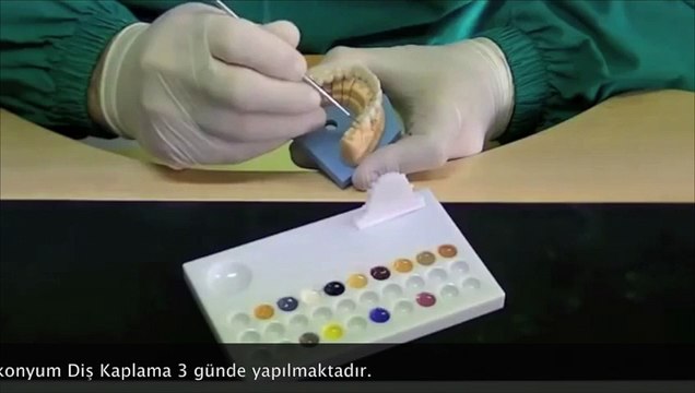 Zirkonyum Diş Kaplama Diş Kliniği Ankara mutludent.com/dis-klinigi-ankara.html