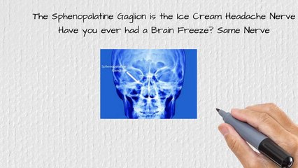 Stamford Do you know what an Ice Cream Headaches is?