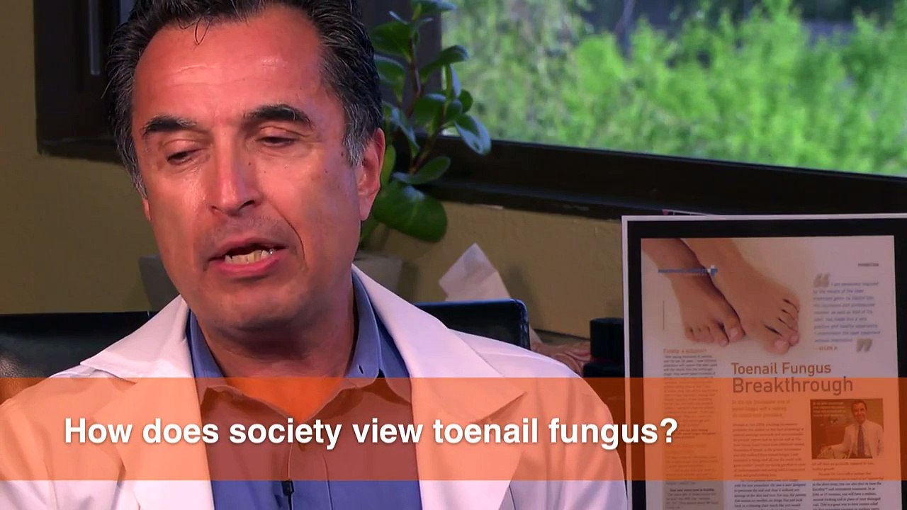 How does society look at toenail fungus?