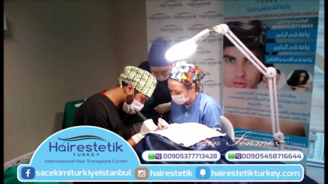 Hair transplatation  greffes de cheveux زراعة الشعر في تركيا
