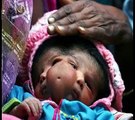 Baby born with four eyes, two mouths and two faces