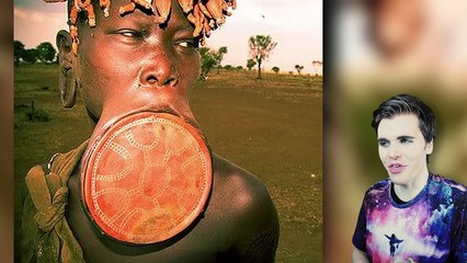 Scarification Gone Wrong (Scar Tattoos)