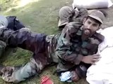 Brave Pakistani SSG Soldier still smiles after being Hit by Bullets on his Leg