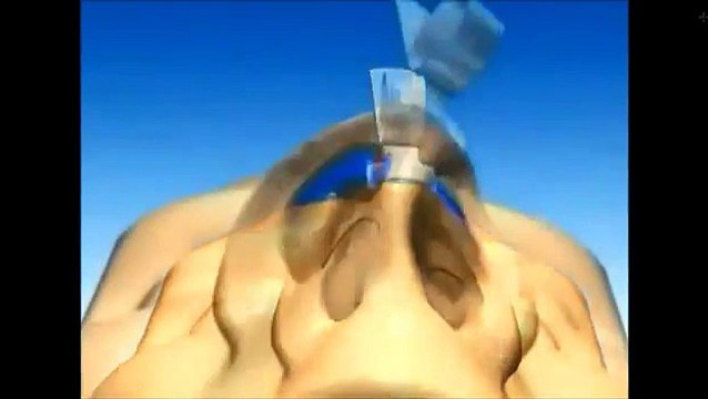 Rhinoplastie Tunisie : Chirurgie du nez