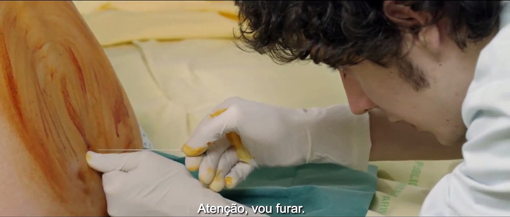 Hipócrates - Trailer