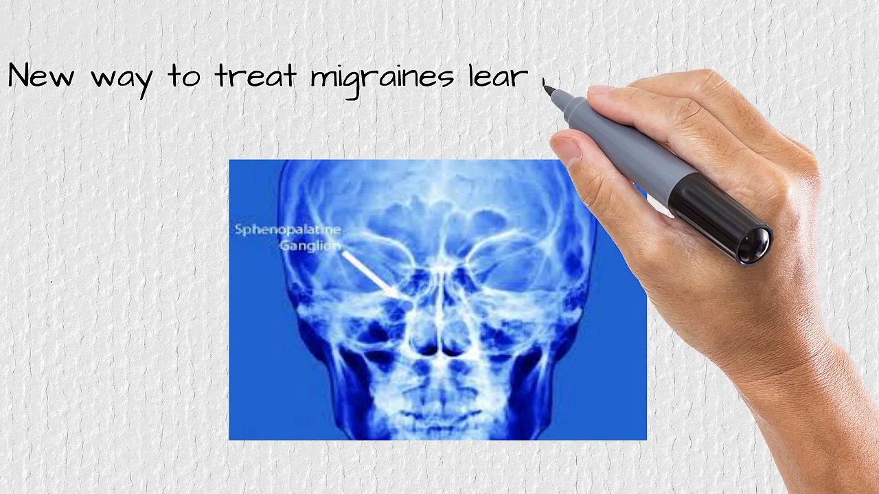 Chiropractor for Headaches Stamford 203 656 3636