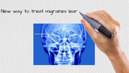 Chiropractor for Headaches Stamford 203 656 3636