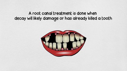 Root Canals in Park City - Mountain High Dental