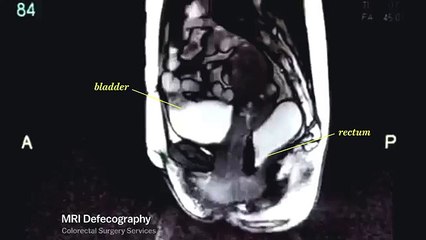 Life looks really different through an MRI machine
