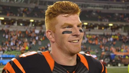 Dalton: Everybody seems to be focusing on my hair