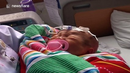 Baby has embryo removed from its body 15 days after birth