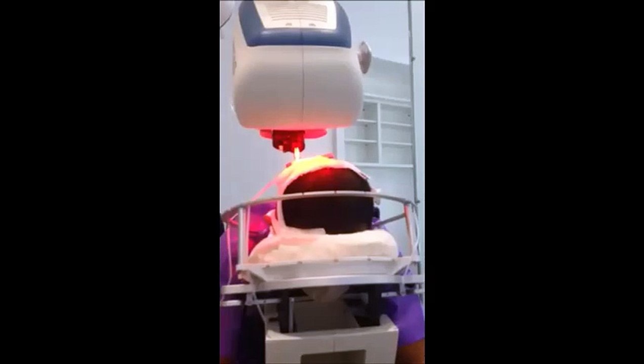 The Clinic Paris Prélèvement implants capillaire à l'aide du robot Artas