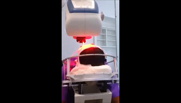 The Clinic Paris Prélèvement implants capillaire à l'aide du robot Artas