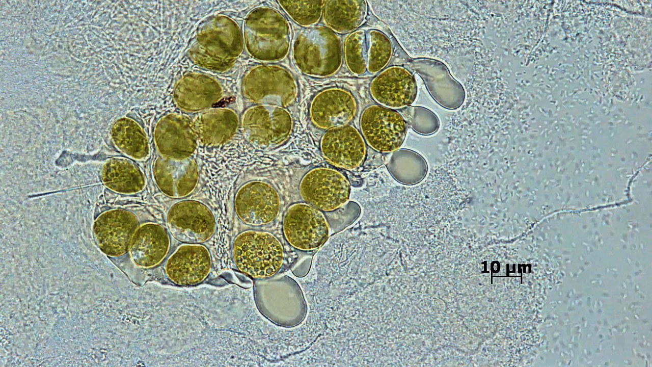 Des algues dans nos villes