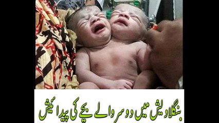 The baby with two heads with same body and organs