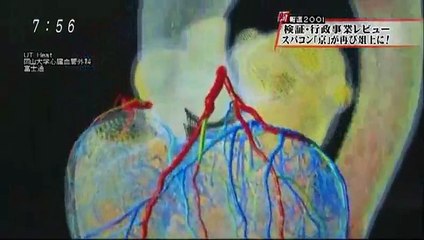 「公僕」 Public Servant 国の召使いなのに王様みたいな生活をする公務員 151115