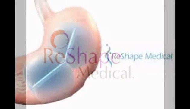 stomach gastric balloon weight loss