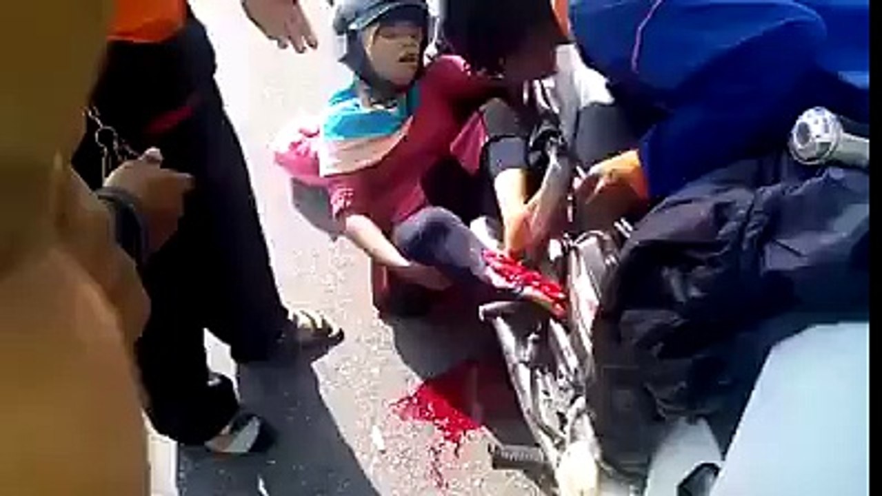 Brutual Accident